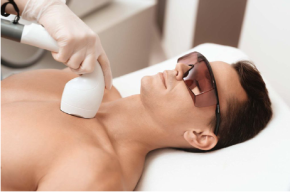 épilation définitive homme à Sens